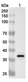 GALE Rabbit Polyclonal Antibody