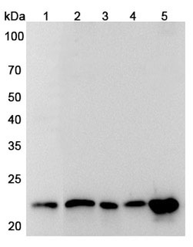 CBX5 Rabbit Polyclonal Antibody