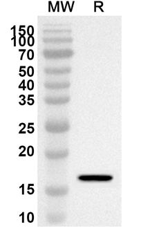 UGCG Rabbit Polyclonal Antibody