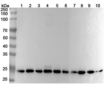 PSMB1 Rabbit Polyclonal Antibody