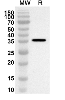 NDUFS6 Rabbit Polyclonal Antibody
