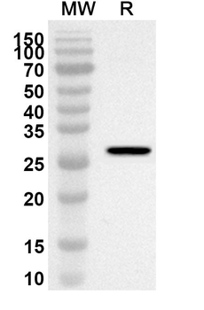OS9 Rabbit Polyclonal Antibody