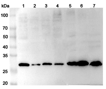 DPT Rabbit Polyclonal Antibody