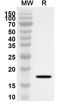 SH3PXD2A Rabbit Polyclonal Antibody