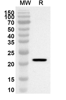 RAB14 Rabbit Polyclonal Antibody