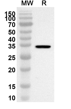 PINX1 Rabbit Polyclonal Antibody