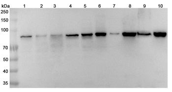 DDX1 Rabbit Polyclonal Antibody