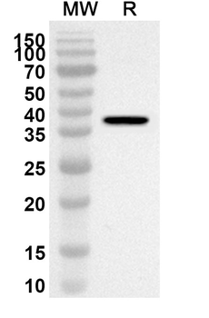 TCF4 Rabbit Polyclonal Antibody
