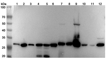 CHCHD3 Rabbit Polyclonal Antibody