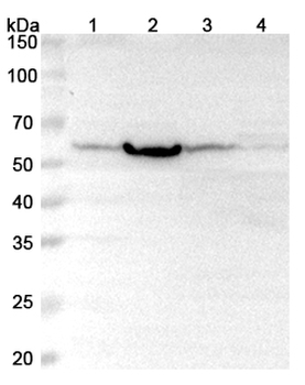 PHGDH Rabbit Polyclonal Antibody