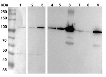 HADHA Rabbit Polyclonal Antibody