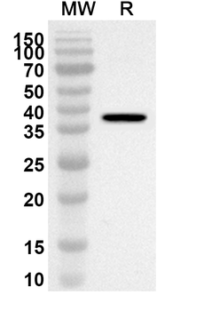 FERMT2 Rabbit Polyclonal Antibody