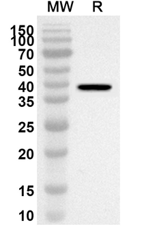 KIF5A Rabbit Polyclonal Antibody