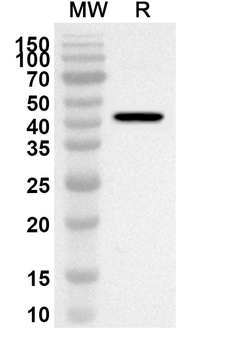 ADH5 Rabbit Polyclonal Antibody