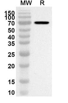 SDHA Rabbit Polyclonal Antibody