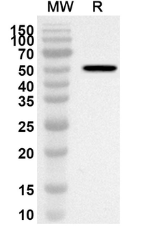 TRIM33 Rabbit Polyclonal Antibody