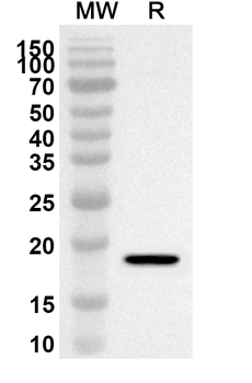 CLEC2D/OCIL/LLT1 Rabbit Polyclonal Antibody