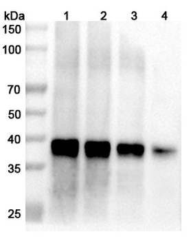 Langya virus/LayV M/Matrix protein Rabbit Polyclonal Antibody