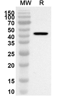 CNOT6 Rabbit Polyclonal Antibody
