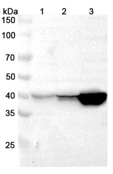 UPB1 Rabbit Polyclonal Antibody