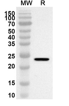 A1CF Rabbit Polyclonal Antibody