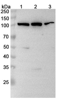 ABCB6 Rabbit Polyclonal Antibody