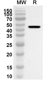 ACAT2 Rabbit Polyclonal Antibody