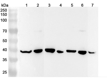 ACAT2 Rabbit Polyclonal Antibody