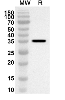 MGLL Rabbit Polyclonal Antibody