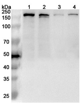 RAD50 Rabbit Polyclonal Antibody