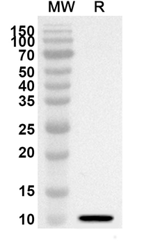 NRGN Rabbit Polyclonal Antibody