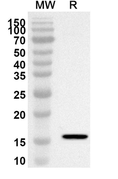 Drebrin 1/DBN1 Rabbit Polyclonal Antibody
