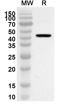 CRY1 Rabbit Polyclonal Antibody