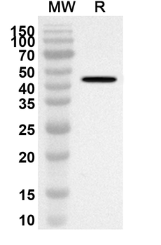 ACOX1 Rabbit Polyclonal Antibody