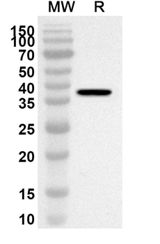 SEMA5A Rabbit Polyclonal Antibody