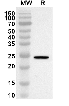 PSMD2 Rabbit Polyclonal Antibody