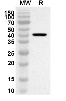 TP53BP1 Rabbit Polyclonal Antibody