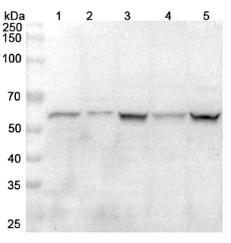 HSPA14 Rabbit Polyclonal Antibody