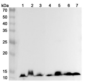 HBA1 Rabbit Polyclonal Antibody