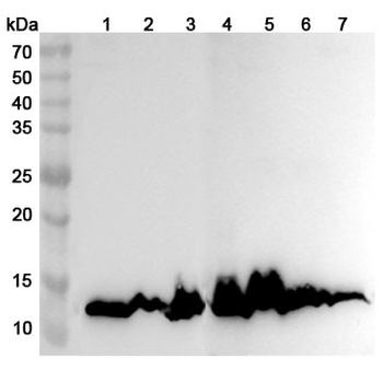 HBA1 Rabbit Polyclonal Antibody