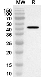 SMA /ACTA2 Rabbit Polyclonal Antibody