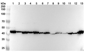 PSMC6 Rabbit Polyclonal Antibody