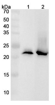 TNNI2 Rabbit Polyclonal Antibody