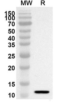 CXCL12/SDF-1 Rabbit Polyclonal Antibody