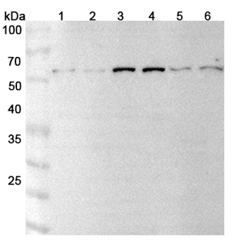ECE1 Rabbit Polyclonal Antibody