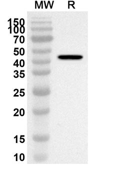 DSG3 Rabbit Polyclonal Antibody