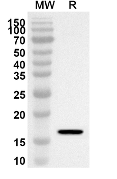 CDA Rabbit Polyclonal Antibody