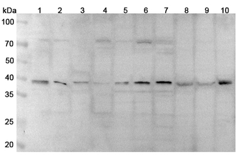 CD32b/FCGR2B Rabbit Polyclonal Antibody