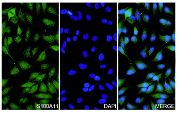 S100A11 Rabbit Polyclonal Antibody