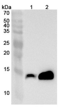 CRABP2 Rabbit Polyclonal Antibody